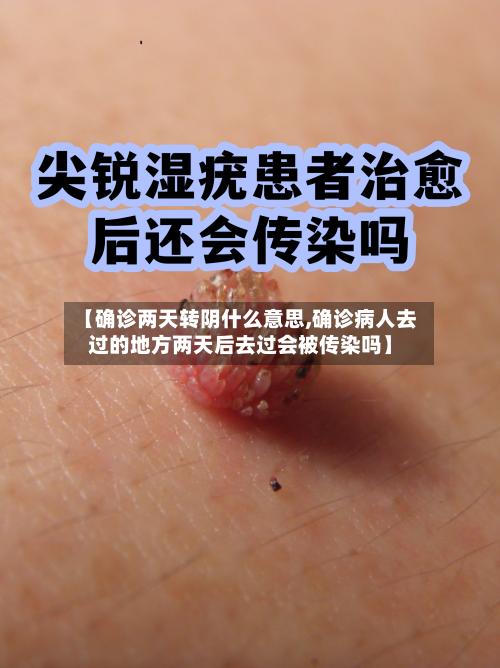 【确诊两天转阴什么意思,确诊病人去过的地方两天后去过会被传染吗】-第2张图片
