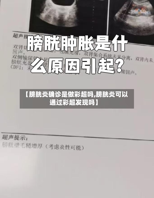 【膀胱炎确诊是做彩超吗,膀胱炎可以通过彩超发现吗】-第2张图片