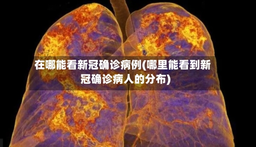 在哪能看新冠确诊病例(哪里能看到新冠确诊病人的分布)-第3张图片